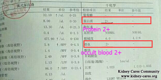 Proteinuria And Hematuria In IgA Nephropathy Is Reduced In Our Hospital