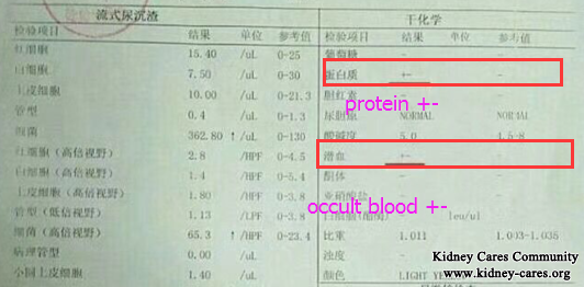 Proteinuria And Hematuria In IgA Nephropathy Is Reduced In Our Hospital