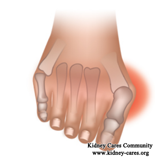 Can Children With Nephrotic Syndrome Develop Osteoporosis