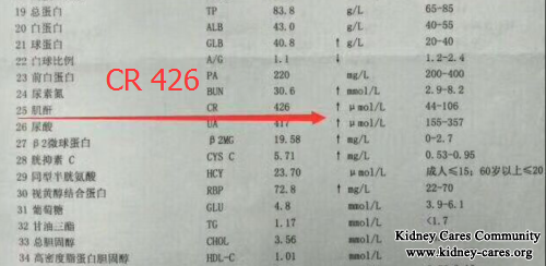 Lupus Nephritis Is Treated Well In Our Hospital