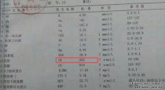 High Creatinine Level Is Reduced To 296umol/L From 655umol/L