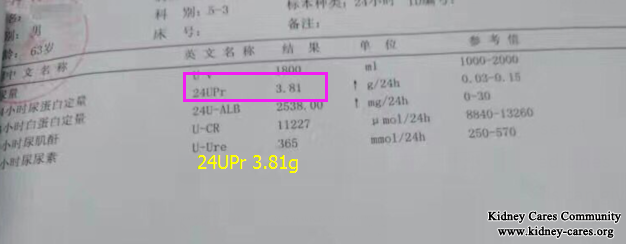 Our Treatment Characteristic In Nephrotic Syndrome