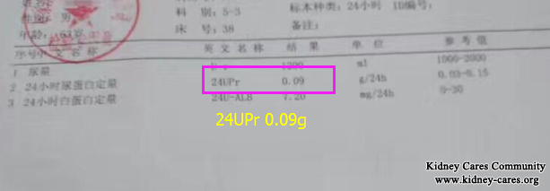 Our Treatment Characteristic In Nephrotic Syndrome