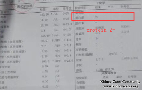 Toxin-Removing Treatment Control Lupus Nephritis